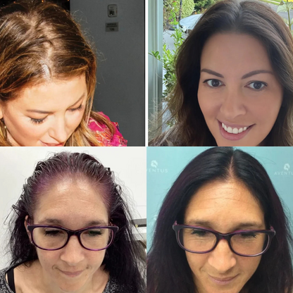 Reformens Hair Growth Serum