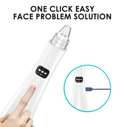 Blackhead Extractor 2.0