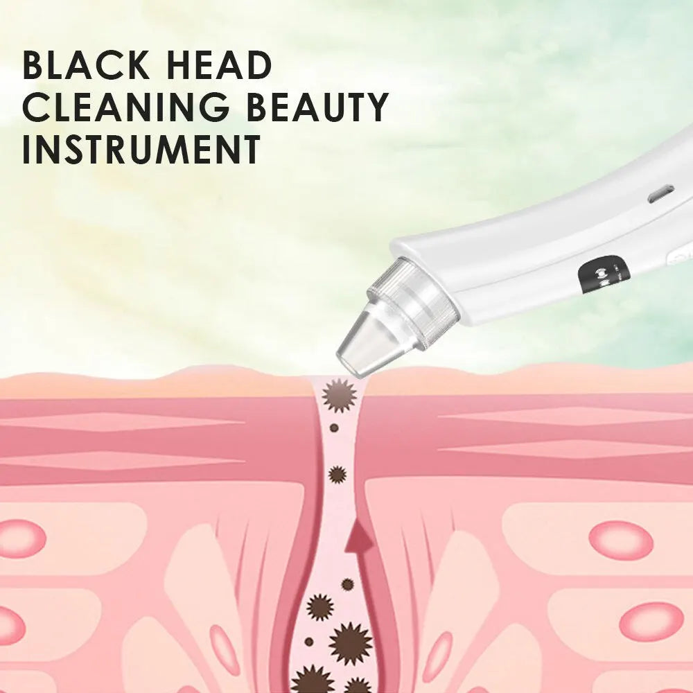 Blackhead Extractor 2.0