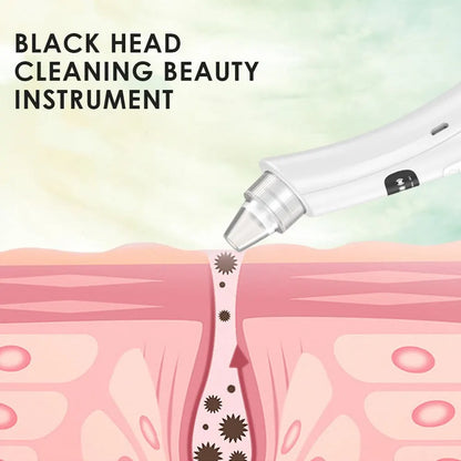 Blackhead Extractor 2.0