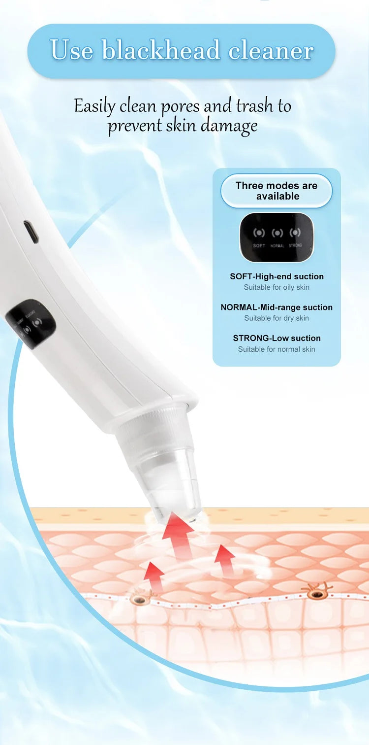 Blackhead Extractor 2.0