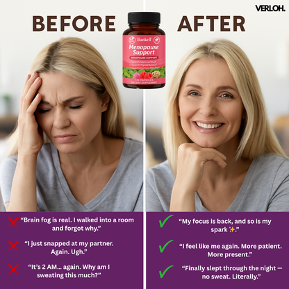 Verlohs Bunkell Support