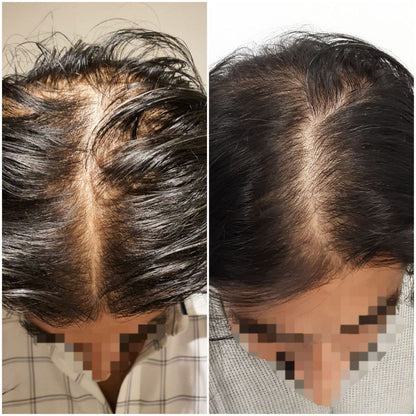Reformens Hair Growth Serum